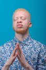 Студийный портрет альбиноса в голубой рубашке с закрытыми глазами — стоковое фото