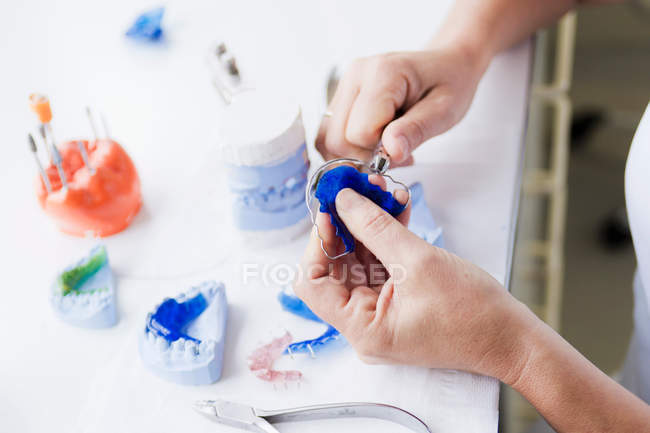 Male hands fixing tooth bracket — Stock Photo