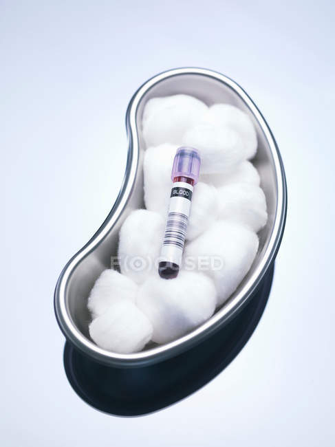 Blood sample and cotton balls — Stock Photo