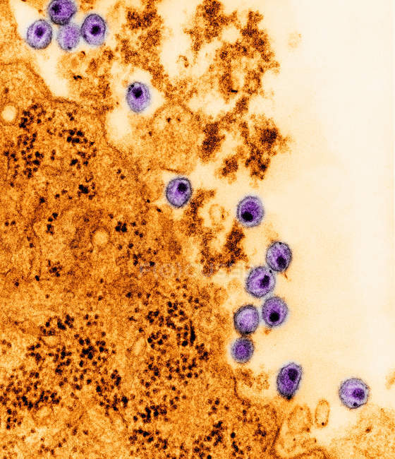 Micrografía electrónica de barrido del virus del VIH - foto de stock
