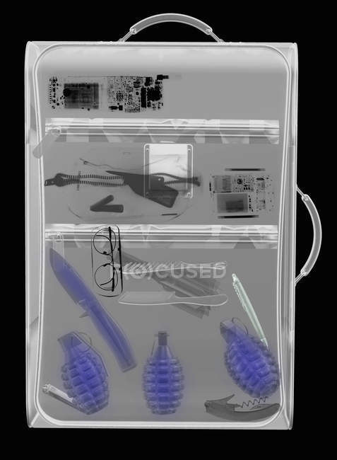 X-ray of a suitcase containing hand grenades and knife — Stock Photo