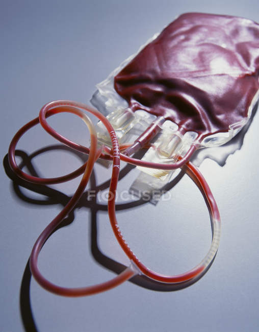 Bolsa que contiene una donación de sangre para uso en transfusiones - foto de stock