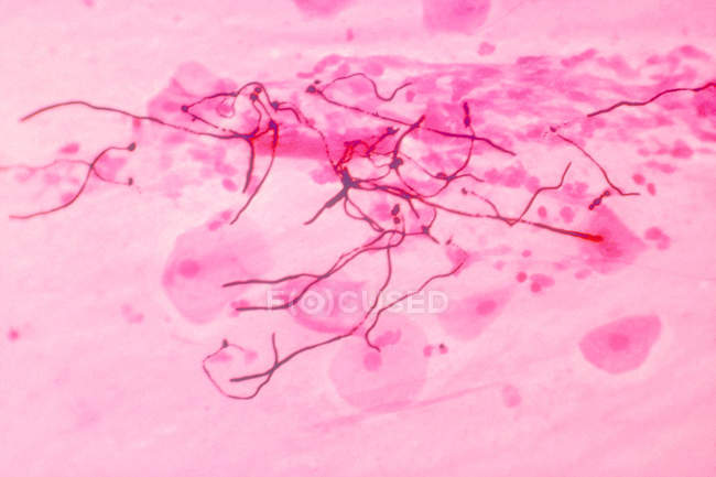 Мікрофотографія candida albicans в тканині легень — стокове фото