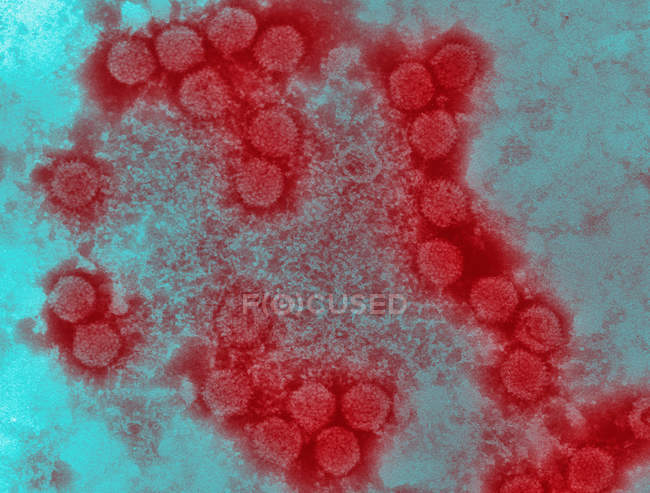Electron micrograph of canine adenovirus — Stock Photo