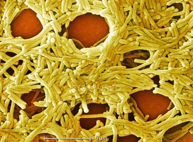 Legionella bacterias con regla escalada - foto de stock