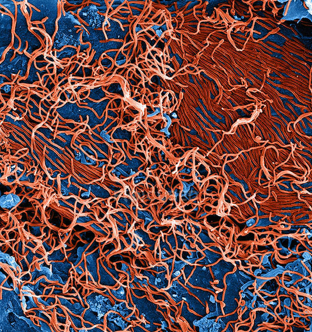 Partículas do vírus ebola provenientes de células vero cronicamente infectadas — Fotografia de Stock