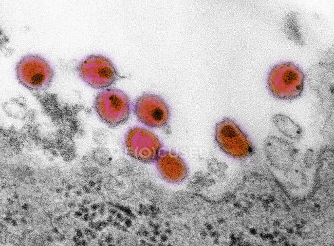 Micrographie électronique à balayage des virions VIH — Photo de stock