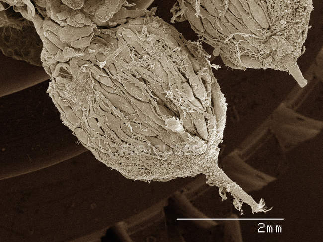Кольоровий скануючий електронний мікрограф яєчників цикади — стокове фото