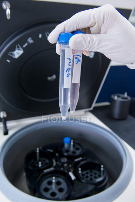 Laboratorio de investigación del cáncer, mano del científico masculino que coloca células en la centrifugadora - foto de stock