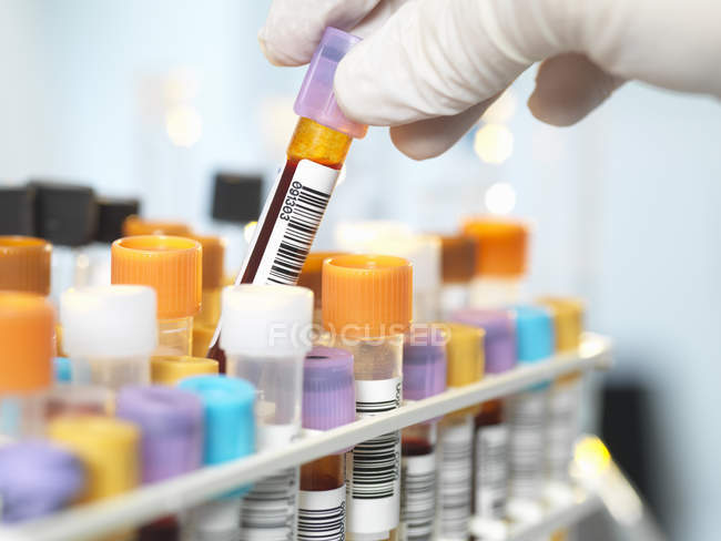Labortechniker bereitet Blutprobe für medizinische Tests im Labor vor — Stockfoto