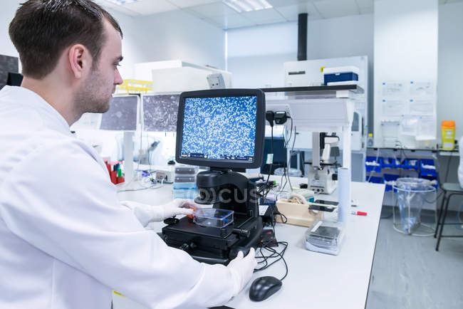 Лабораторія дослідження раку, вчений вивчає клітини під мікроскопом за допомогою екрану комп'ютера — стокове фото