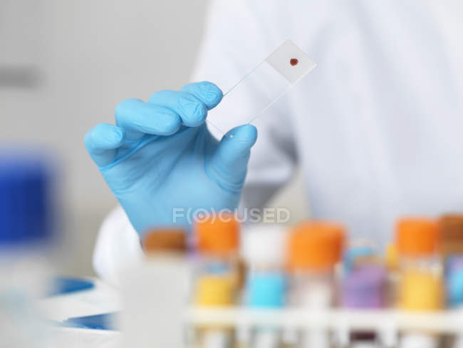 Primer plano de los científicos sosteniendo la muestra de sangre en una diapositiva de microscopio de vidrio para pruebas médicas - foto de stock