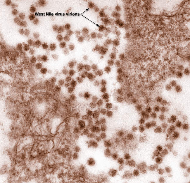 Micrografía electrónica de barrido del virus del Nilo Occidental - foto de stock