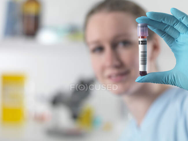 Técnico sosteniendo muestra de sangre codificada con barra en laboratorio clínico - foto de stock