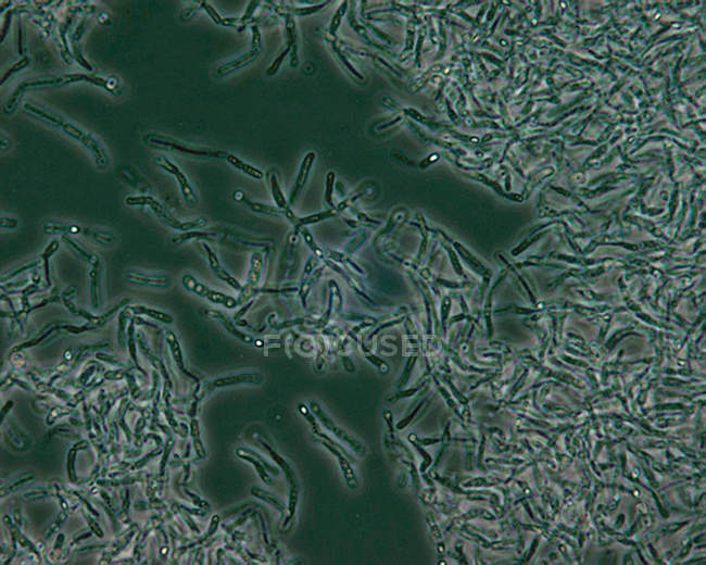 Сканирующий электронный микрограф спор бациллы антрацис — стоковое фото