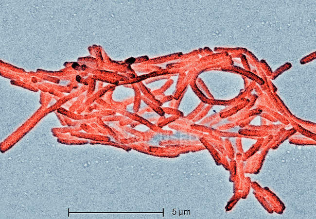 Micrographie électronique de la bactérie legionella, 6500x — Photo de stock