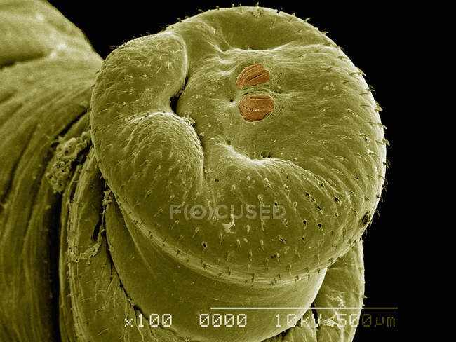 Micrografía electrónica de barrido de espiráculos posteriores de mosca bot humana - foto de stock