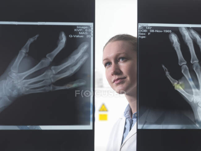 Doctor viewing x-ray of hand in hospital — Stock Photo