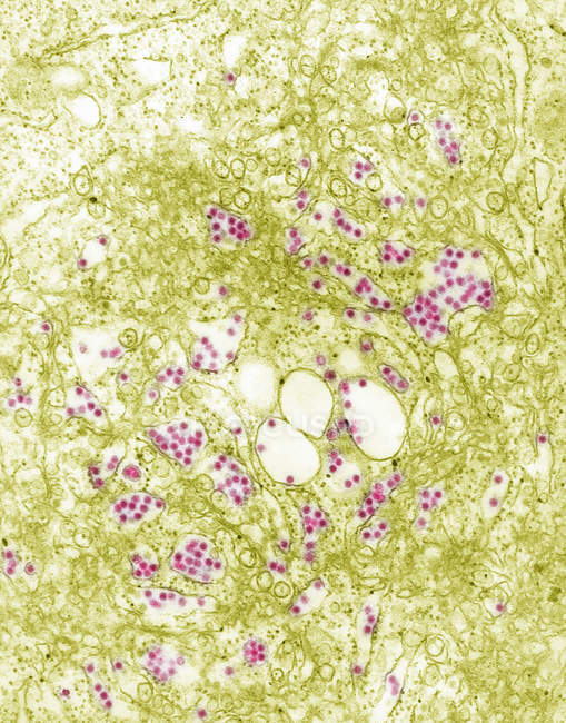 Scanning electron micrograph of russian spring-summer encephalitis — Stock Photo