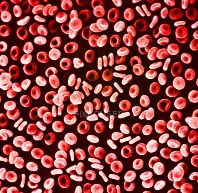 Micrografía electrónica de barrido de glóbulos rojos - foto de stock