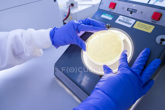 Cancer research laboratory, female scientist studying cells growing in agar viewed under a lamp — Stock Photo