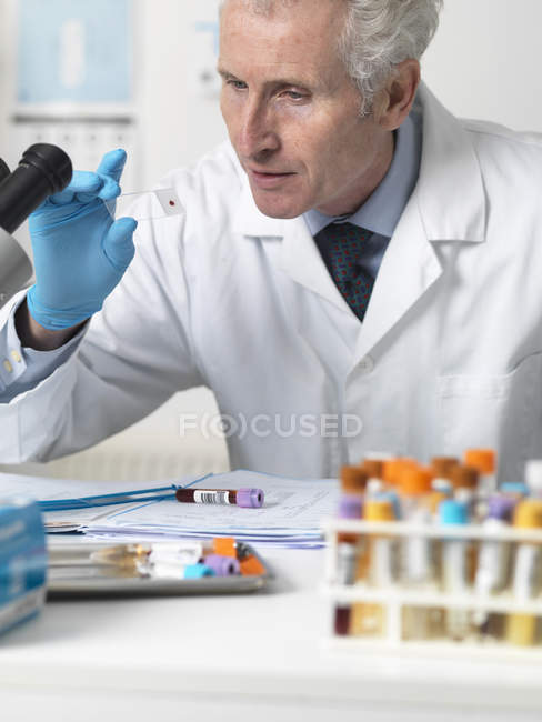 Лікар дивлячись на пацієнтів кров слайд під мікроскопом з іншими зразками для тестування — стокове фото
