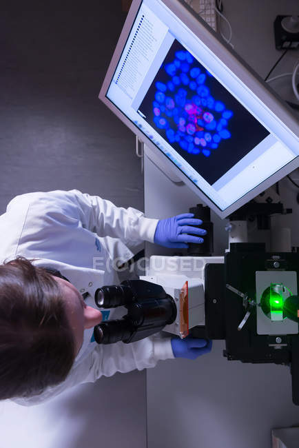 Laboratorio de investigación del cáncer, vista aérea de una científica que estudia células cancerosas bajo microscopio electrónico - foto de stock
