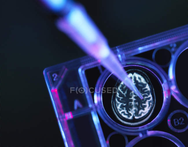 Исследования болезни Альцгеймера и слабоумия, сканирование мозга в многоколодезном подносе, используемом для научных экспериментов в лаборатории — стоковое фото