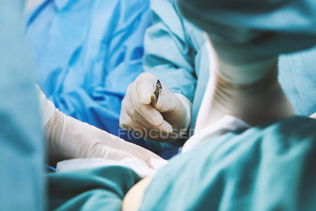 Detalhe do cirurgião segurando bisturi na maternidade sala de operações — Fotografia de Stock