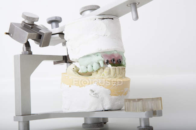 Тестирование набора зубов в лаборатории — стоковое фото