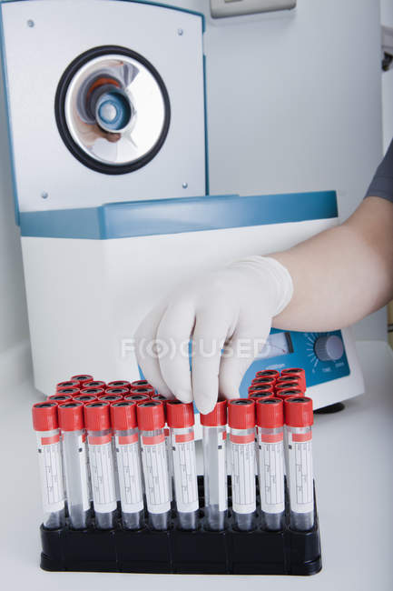 Woman working with test tubes in dental laboratory — Stock Photo