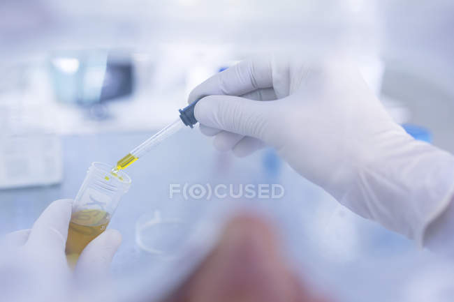 Labormitarbeiter entnimmt Flüssigkeit aus dem Reagenzglas, mit Pipette, Nahaufnahme — Stockfoto