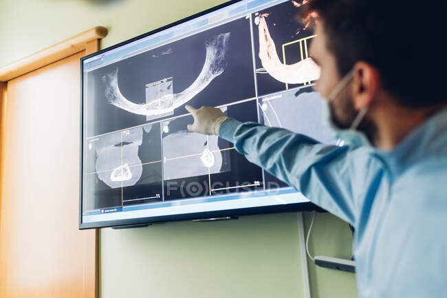 Дантист смотрит на рентгеновские снимки зубов, фокусируется на фоне — стоковое фото