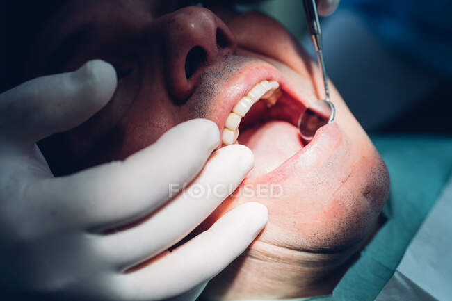 Стоматолог, выполняющий стоматологическую процедуру на пациенте мужского пола, крупным планом — стоковое фото