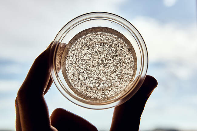 Mano sosteniendo un vaso con bacterias transparentes - foto de stock