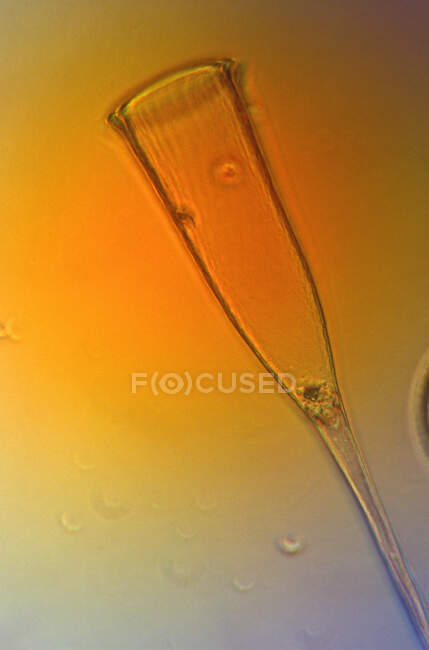 Микроскопический вид на тинтиннид — стоковое фото
