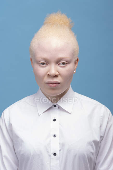 Студійний портрет альбіноїстки в білій сорочці — стокове фото