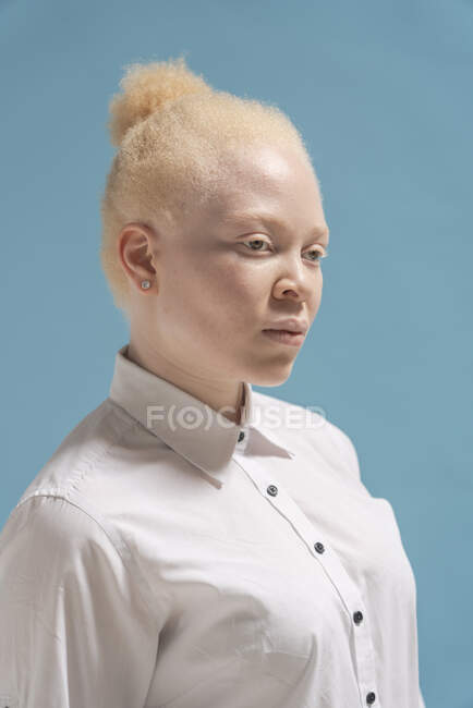 Studio ritratto di donna albina in camicia bianca — Foto stock