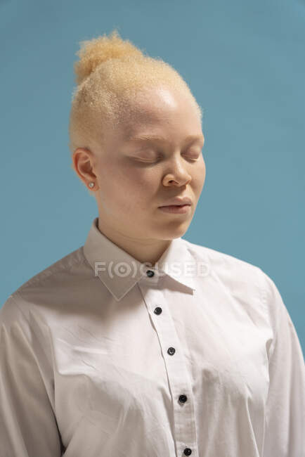 Студійний портрет альбіноїстки в білій сорочці — стокове фото