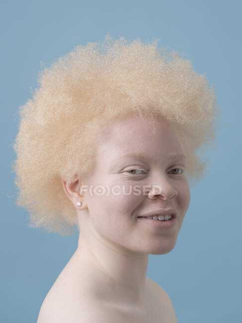 Studioporträt einer lächelnden Albino-Frau — Stockfoto