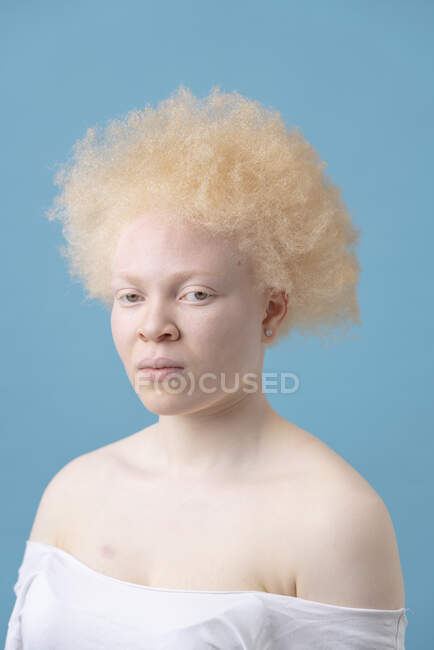 Retrato de estudio de mujer albina - foto de stock