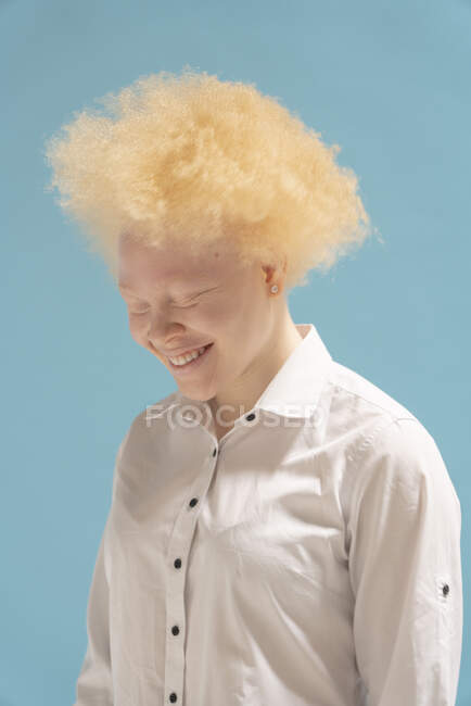 Студійний портрет усміхненої альбіноїстки в білій сорочці — стокове фото
