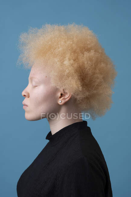 Retrato de estúdio da mulher albina com os olhos fechados — Fotografia de Stock