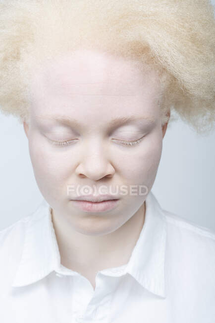 Primo piano della donna albina con gli occhi chiusi — Foto stock