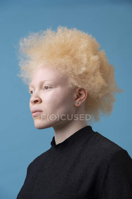 Retrato de estúdio de mulher albina — Fotografia de Stock