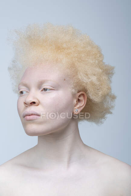 Studioporträt einer Albino-Frau — Stockfoto