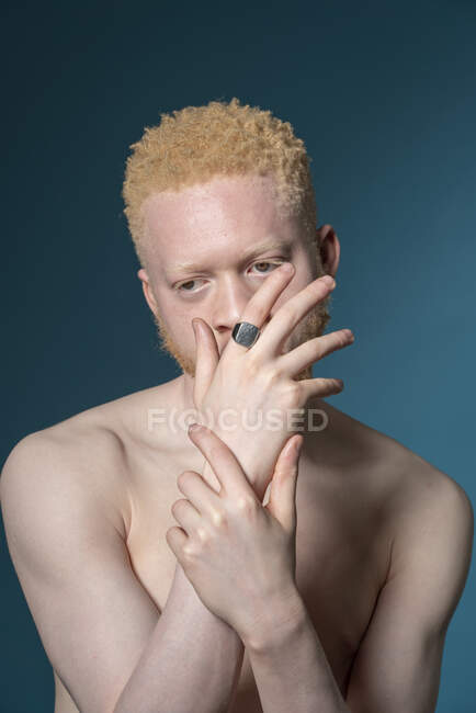 Studio portrait of shirtless albino man — Stock Photo