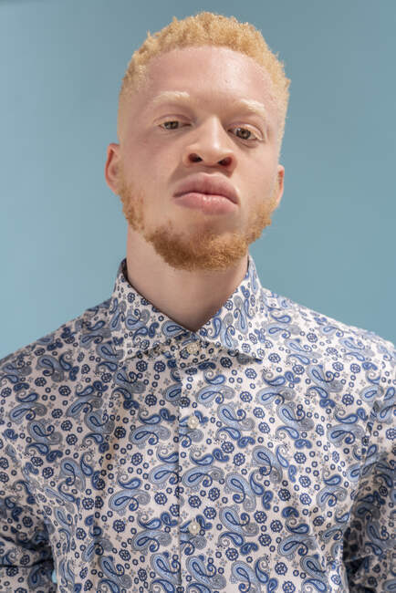 Studio portrait of albino man in blue patterned shirt — Stock Photo
