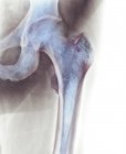 Здоровый тазобедренный сустав — стоковое фото