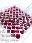 Muestras de sangre en tubos de ensayo - foto de stock